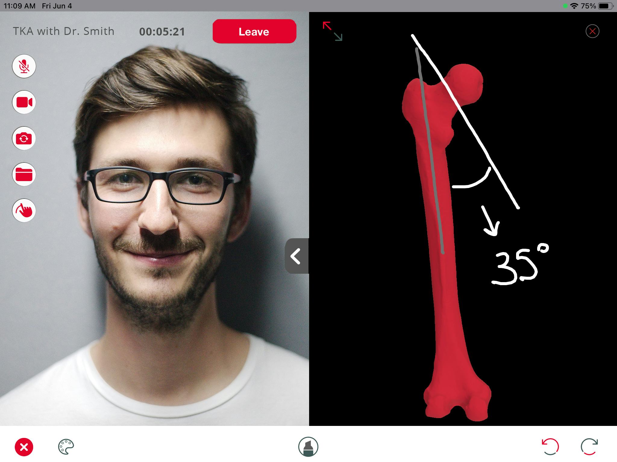 Enhatch Software - Our HIPPA-Compliant Videoconferencing and Collaboration software allows Reps to remote into the OR and work with the surgeon in realtime during a surgery.