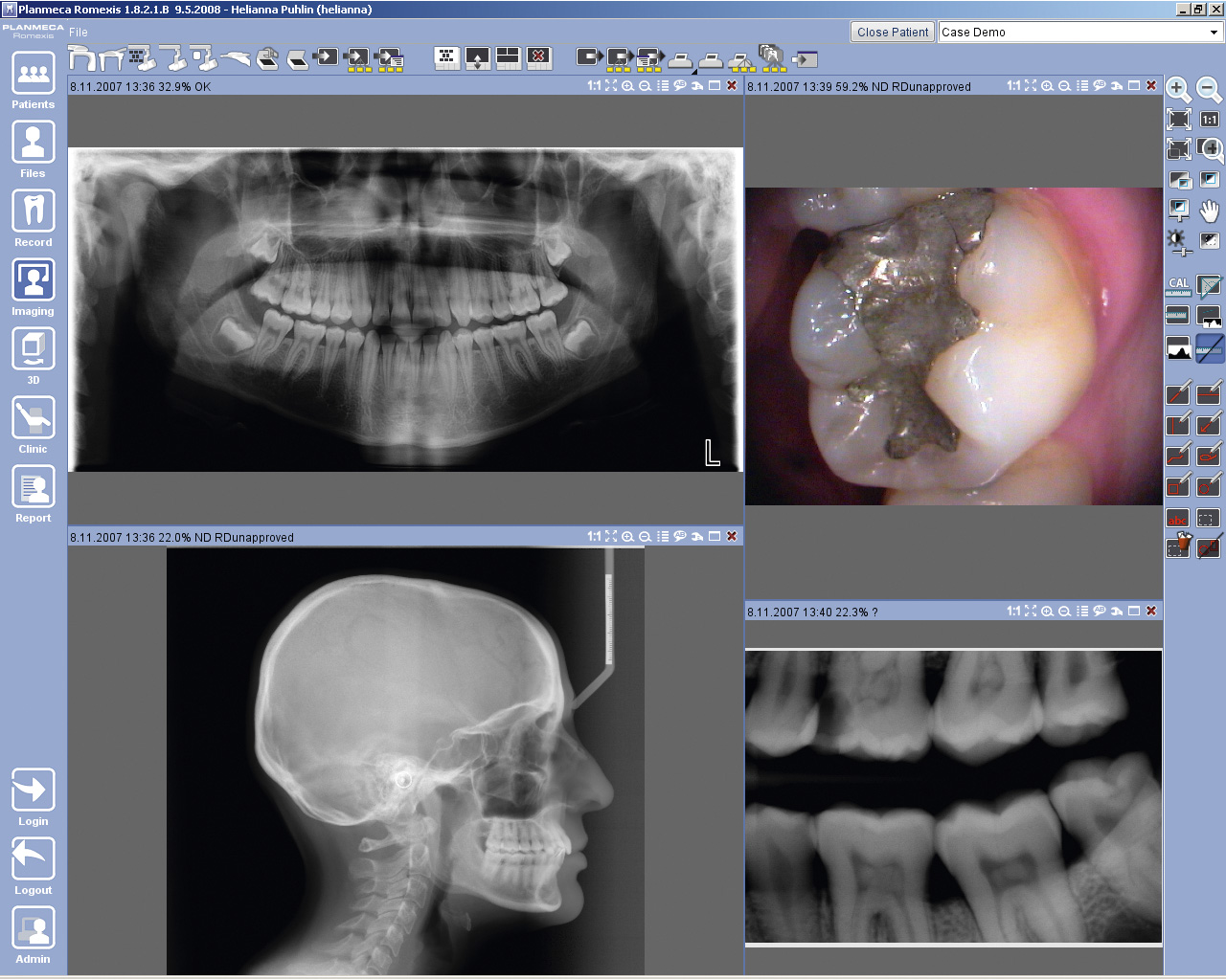 Planmeca Romexis Software - Imaging file