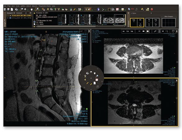 IntelePACS screenshot: IntelePACS radiology images