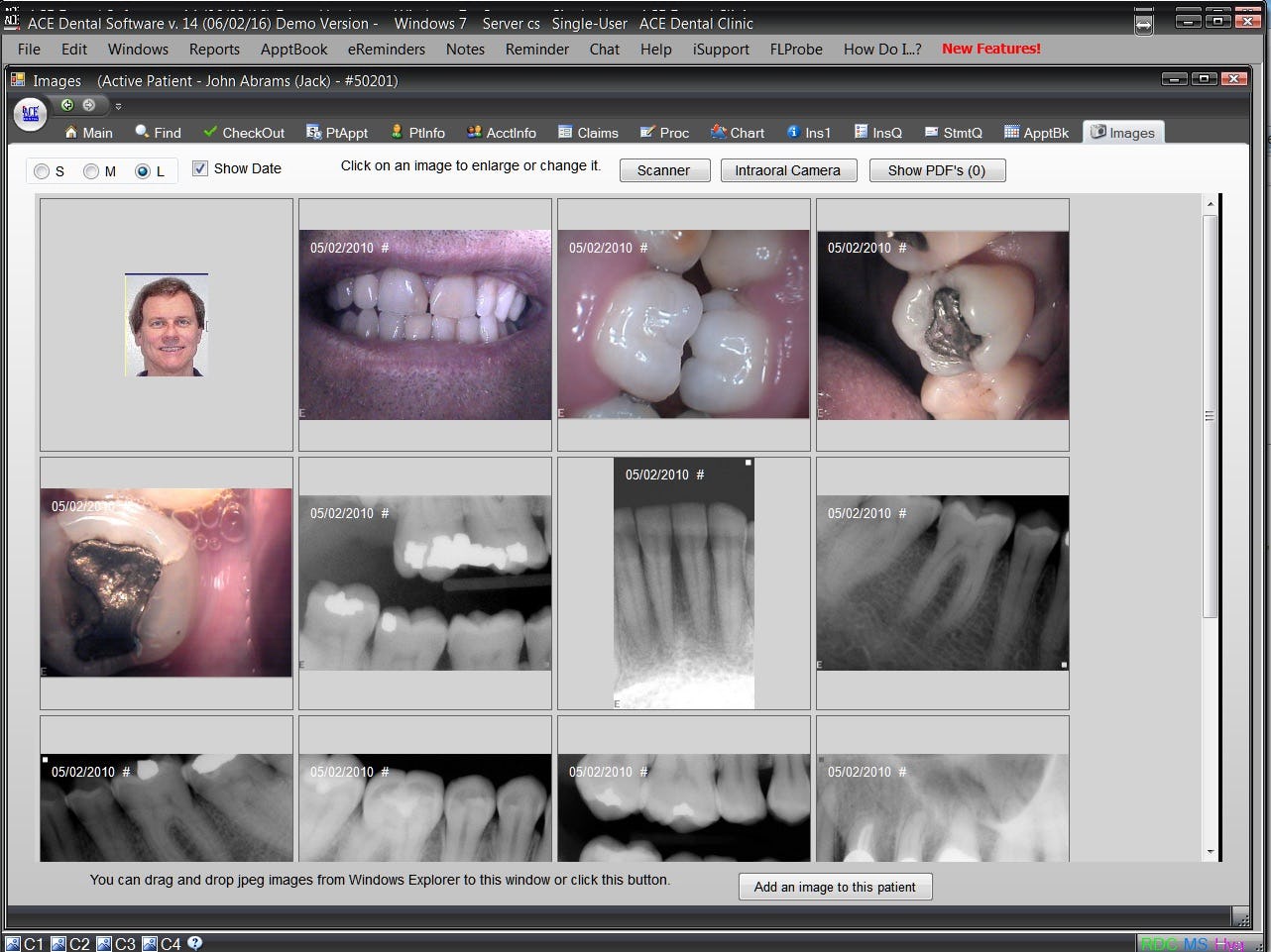 Ace Dental Software 2024 Reviews Pricing And Demo