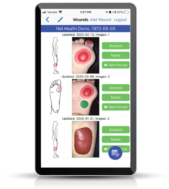 WoundExpert screenshot