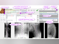 Spinalogic Software - 1 - Vorschau