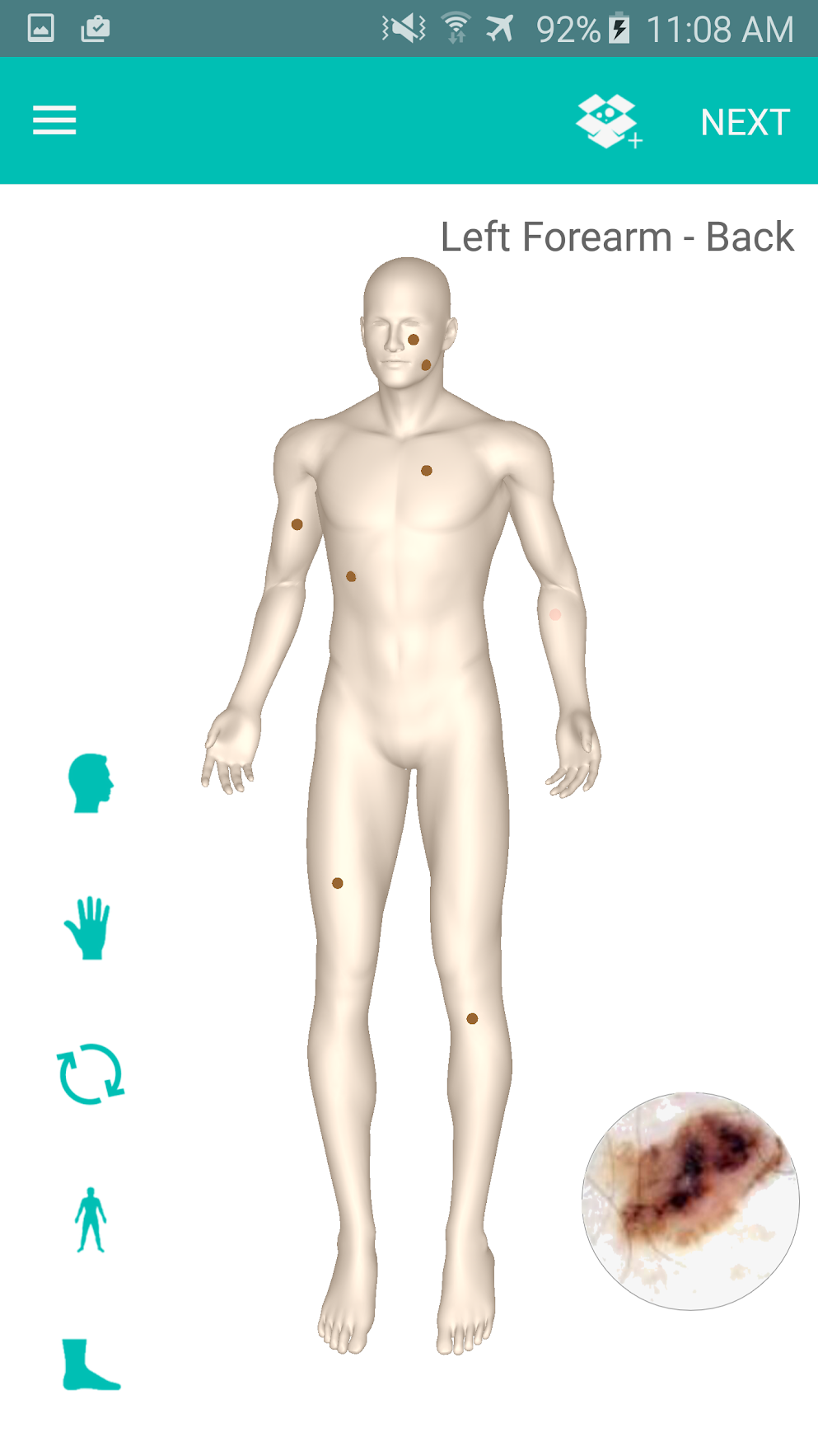 Add, locate, and edit a patient's spot profile with ease using the patient's personal 3D Body Map.