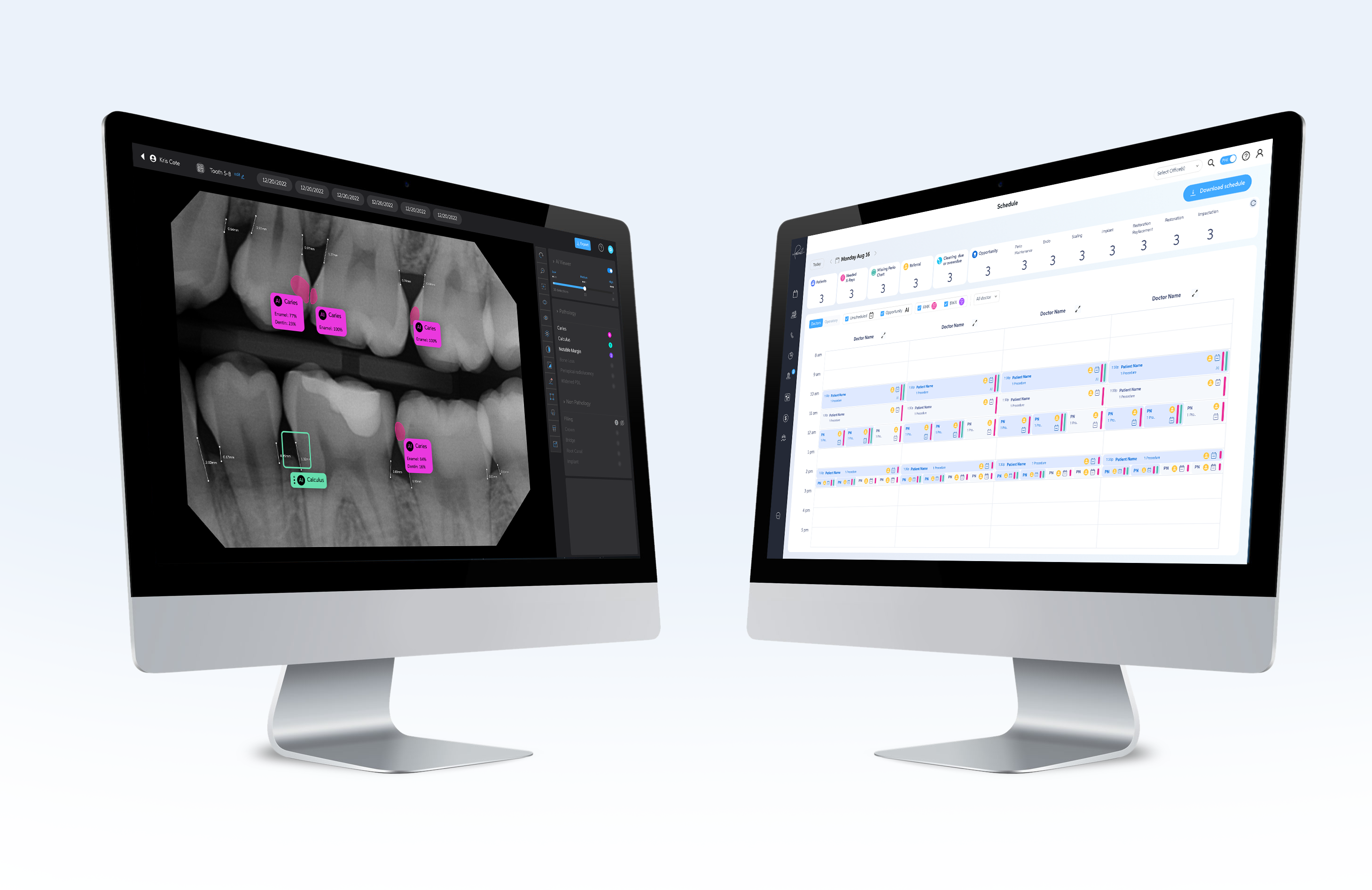 Pearl’s solutions introduce the most state-of-the-art radiologic dental AI technologies to chairside patient care and day-to-day office operations.