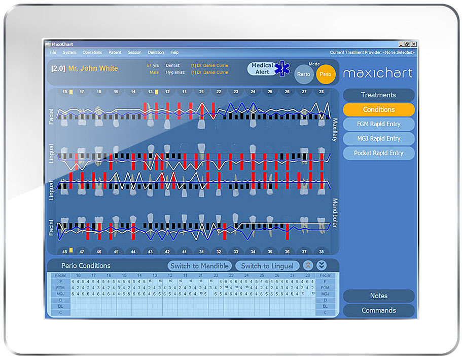 Maxident Software - Maxident's electronic dental charting software, MaxiChart