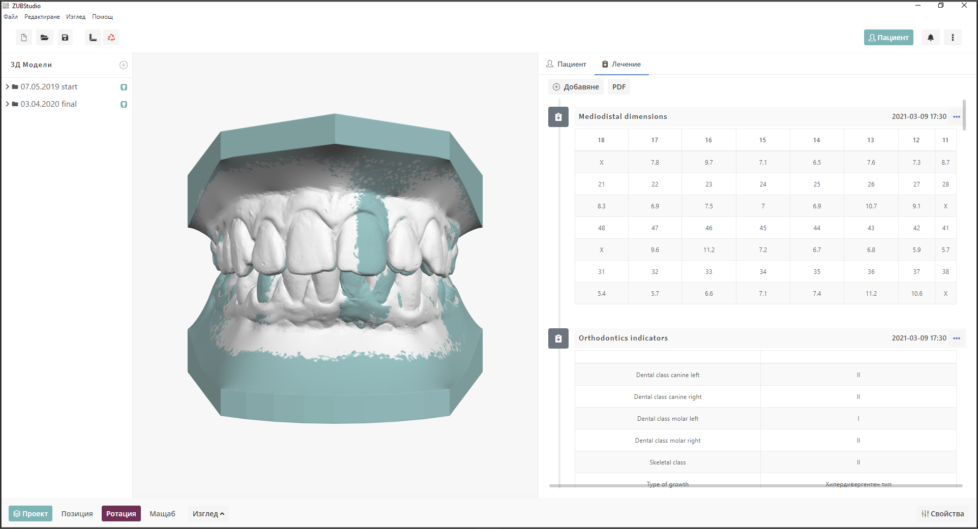 ZUB Studio screenshot: Superimposition and digital measurements