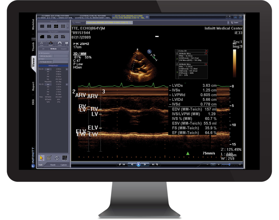 INFINITT Cardiology Suite Software - 2