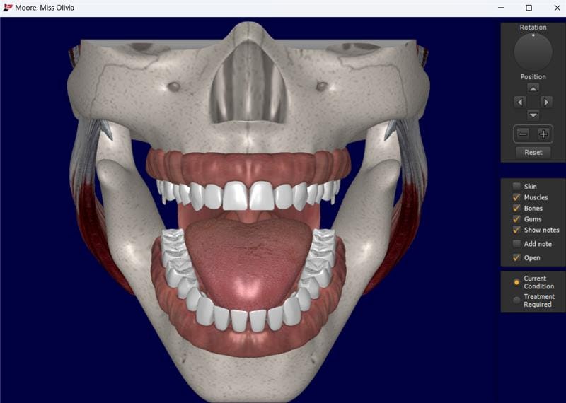 Dental4Windows Software - 1