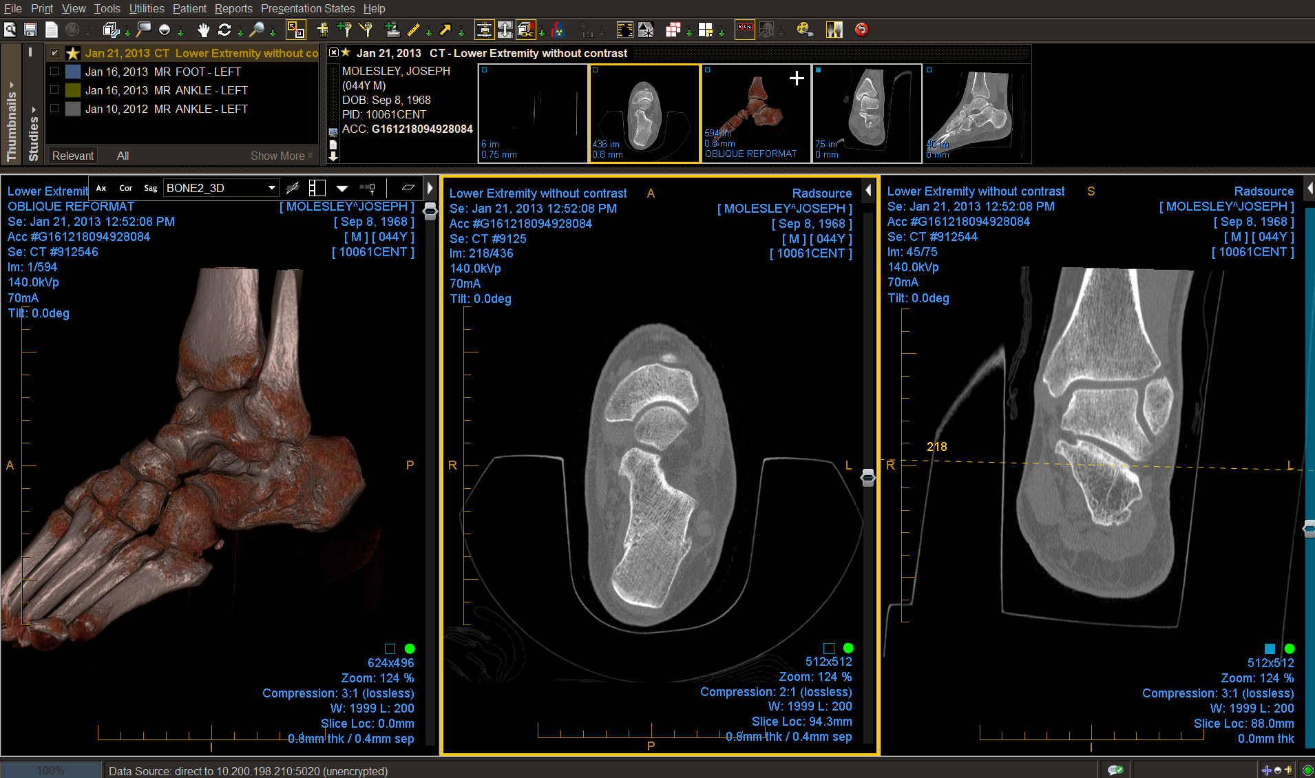 Ankle CT demonstrating viewer capability
