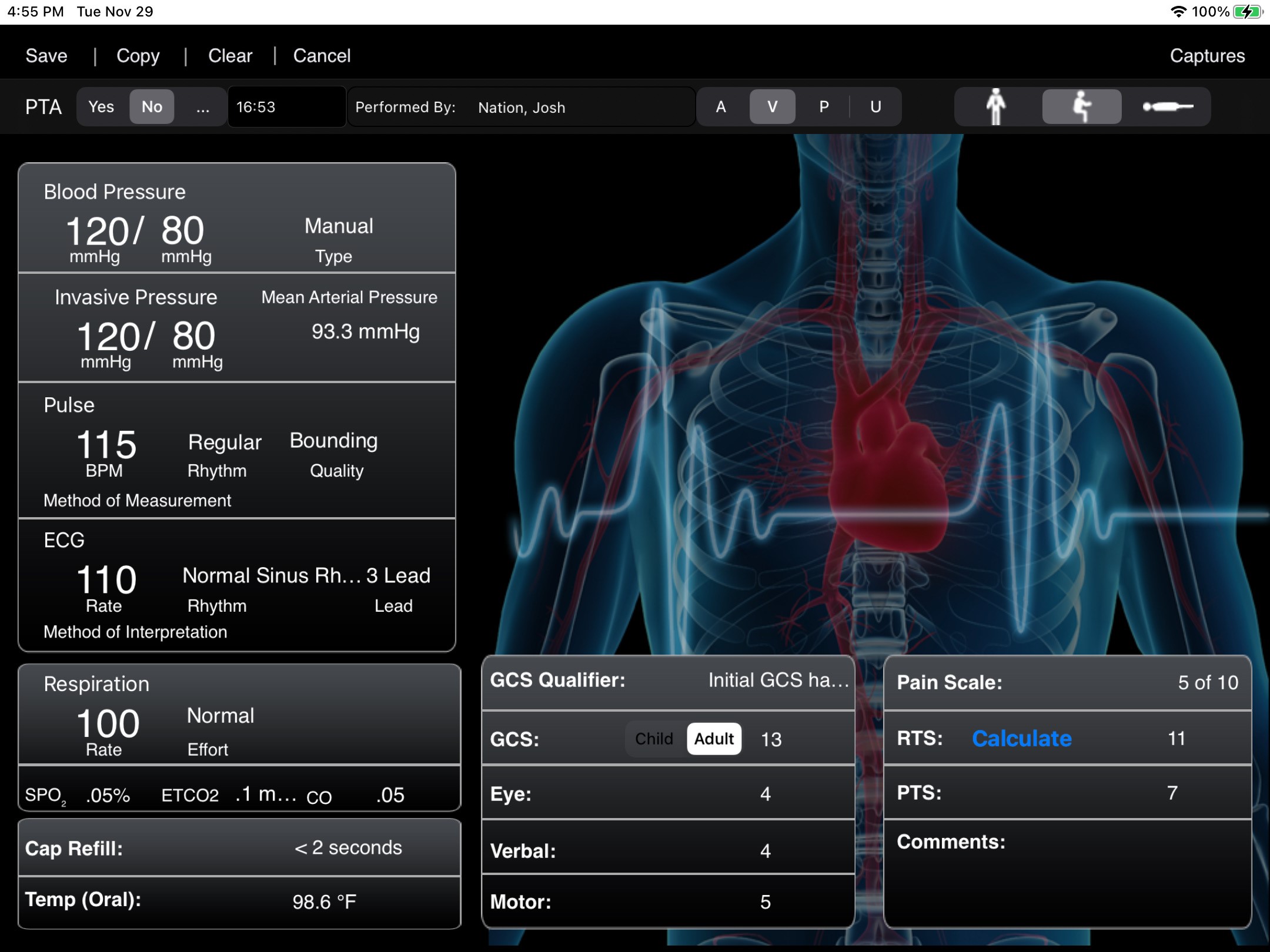 iPCR screenshot: Reporting