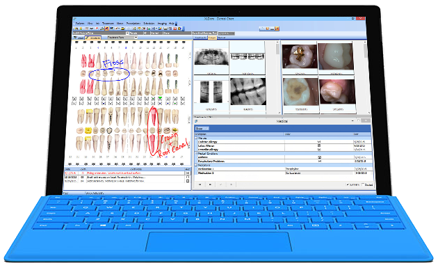 XLChart Software - 1