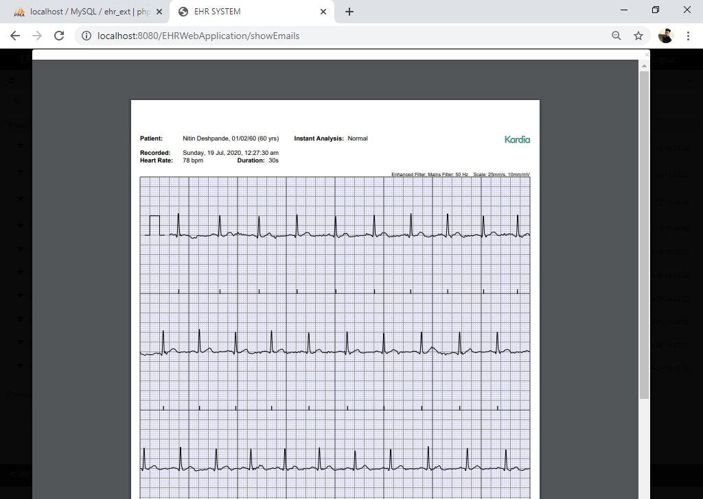 iHomecare Software - iHomecare ECG monitoring