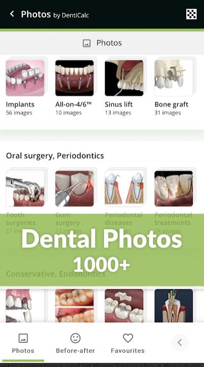 DentiCalc Software - 2