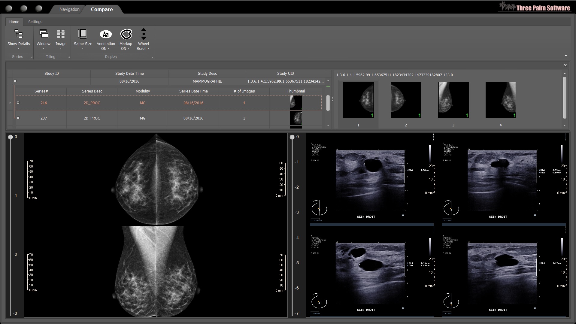 Included plug-in comparison viewer for any combination of modalities.