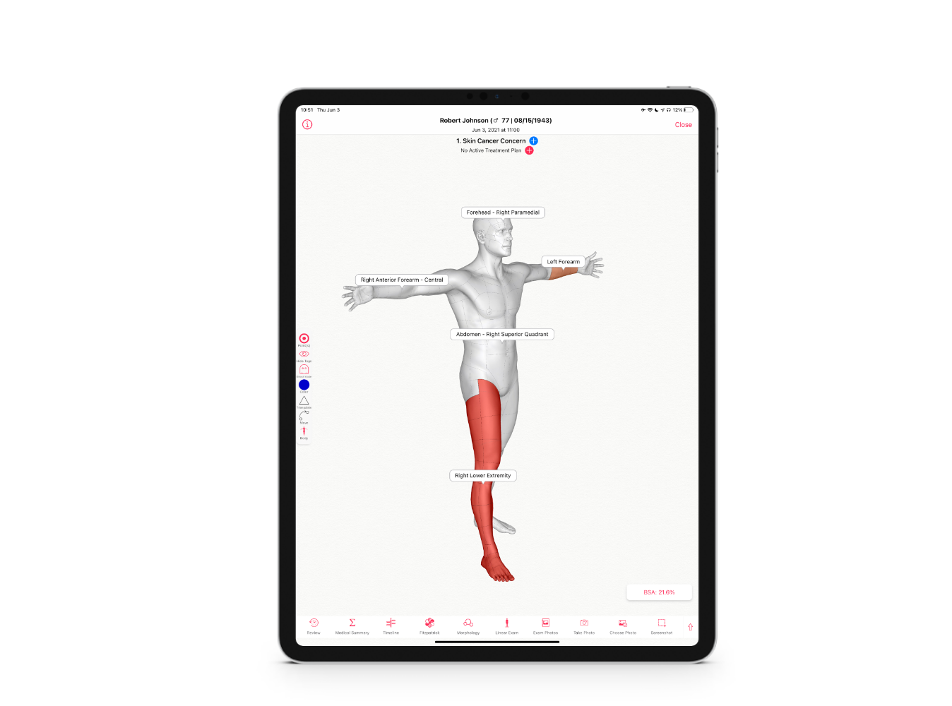 Genuine 3D Anatomical Maps