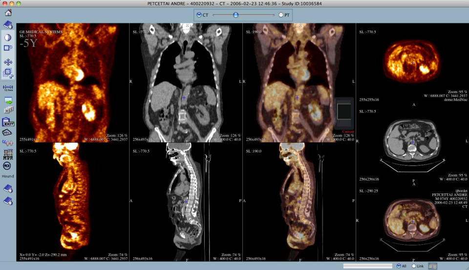 Telemis-Medical PACS Software - 1