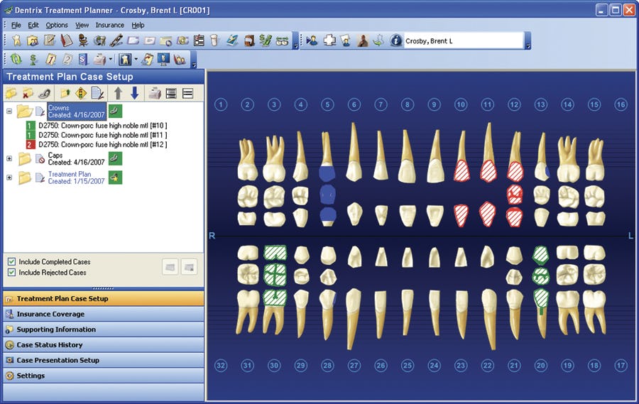 Dentrix Software - 2