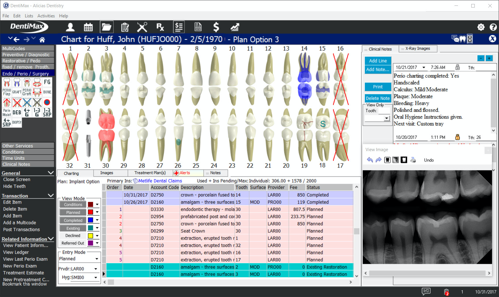DentiMax Software - DentiMax Treatment Planning Screen