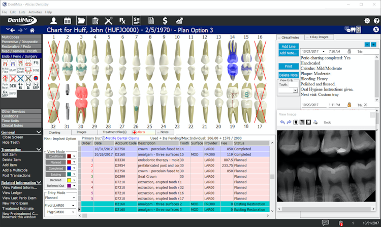 DentiMax screenshot: DentiMax Treatment Planning Screen