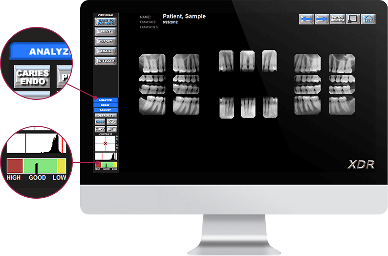 XDR Dental Imaging Pricing, Alternatives & More 2022 Capterra