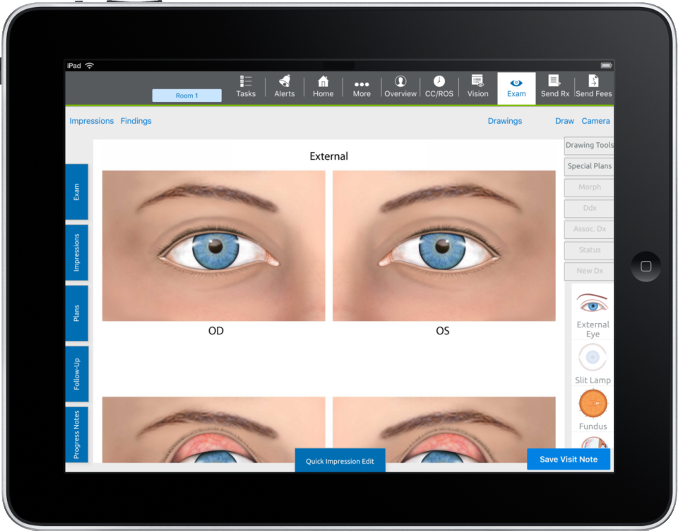 Eyefinity EHR Software - 1