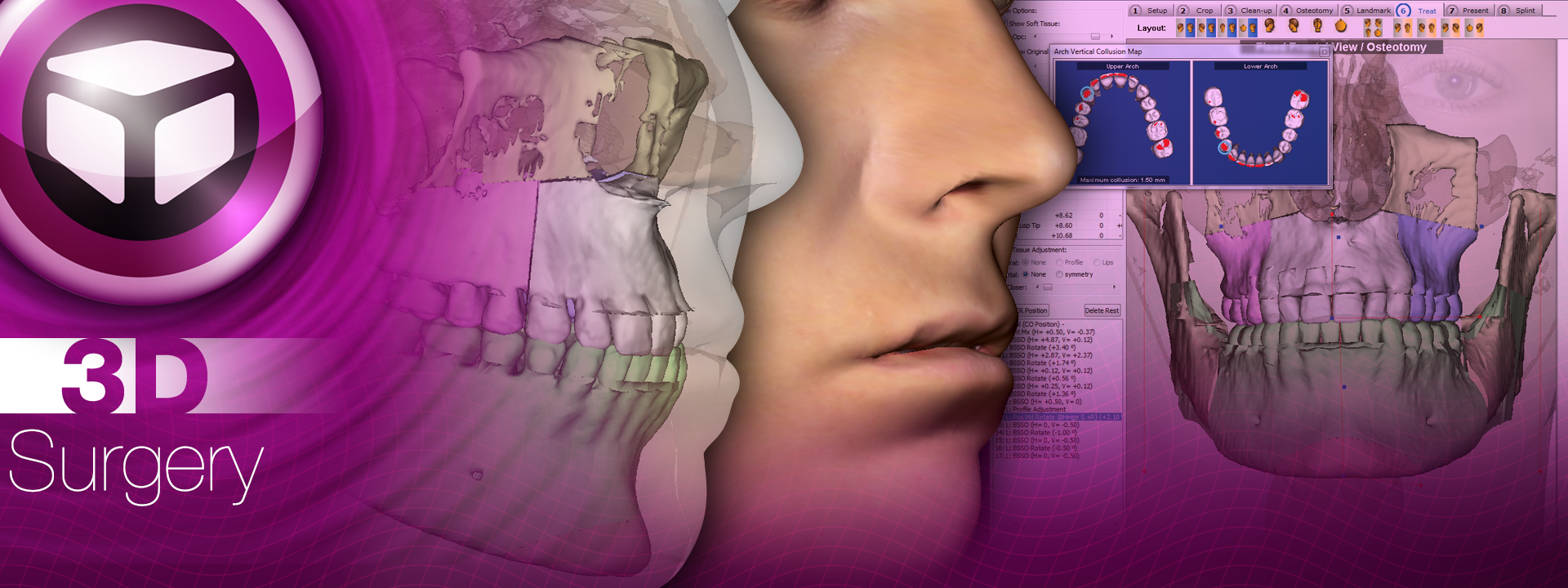 3D Surgery is a comprehensive case planning and presentation tool that animates the patient’s skeletal and facial changes in real time, and outputs to a precise surgical guide.