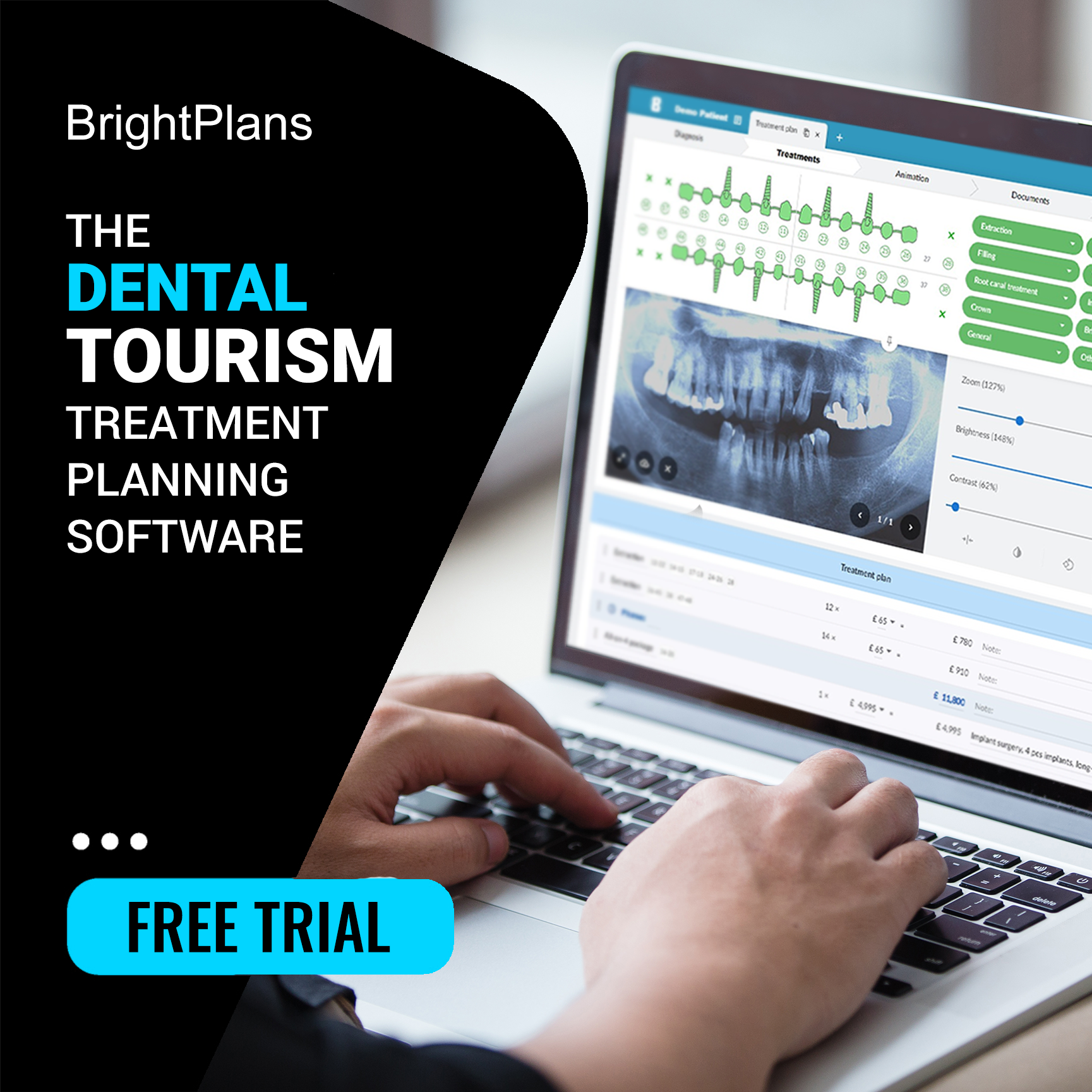 BrightPlans - The Dental Tourism Treatment Planning Software